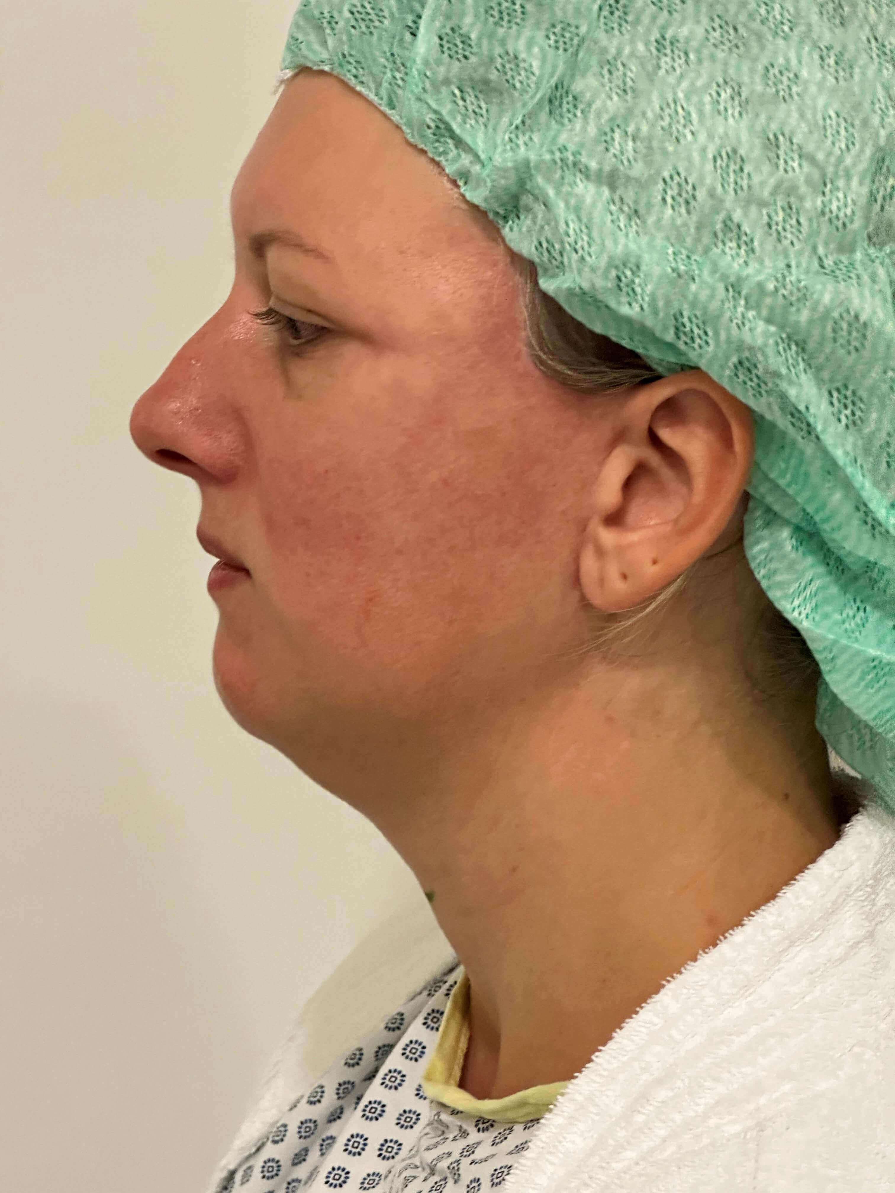 Patientin vorherr
